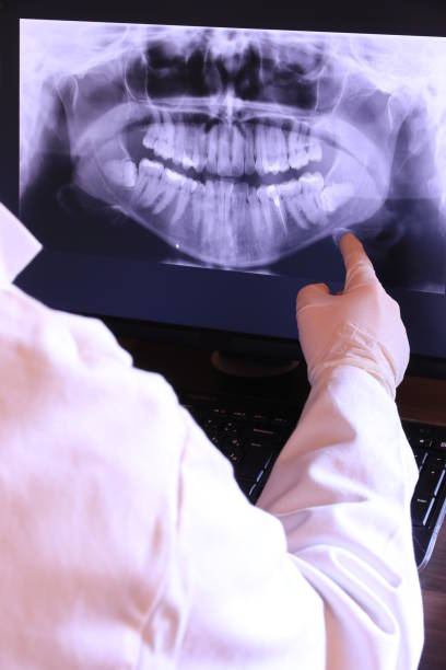 Best Dental Abscess Treatment in Nashville, IN
